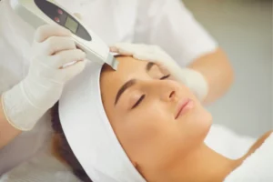 Carbon Laser Facial In Dwarka