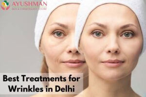 Best Treatments for Wrinkles in Delhi