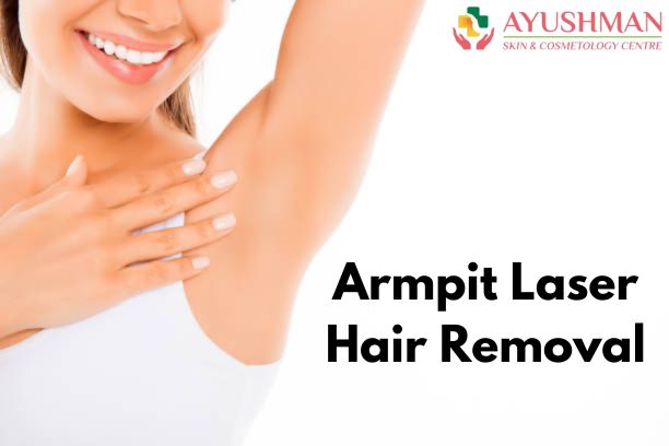 Armpit Laser Hair Removal