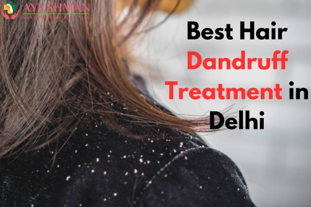 Best Hair Dandruff Treatment in Delhi