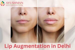 Get Natural-Looking Lips With Our Lip Augmentation in Delhi