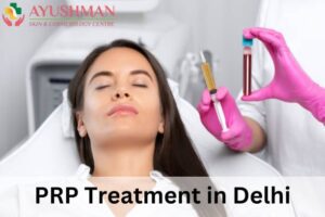 PRP Treatment in Delhi