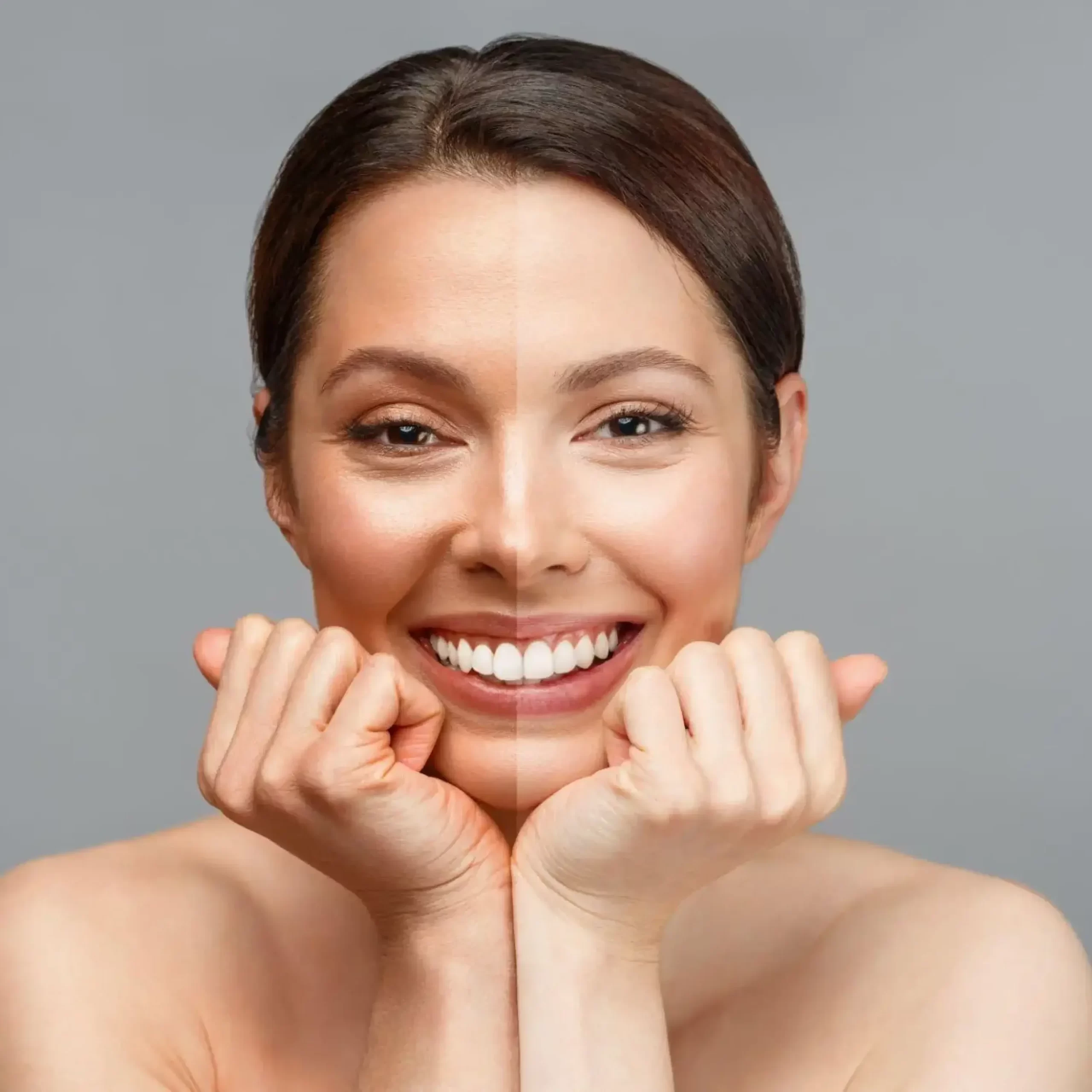 Skin Lightening Treatment in Delhi