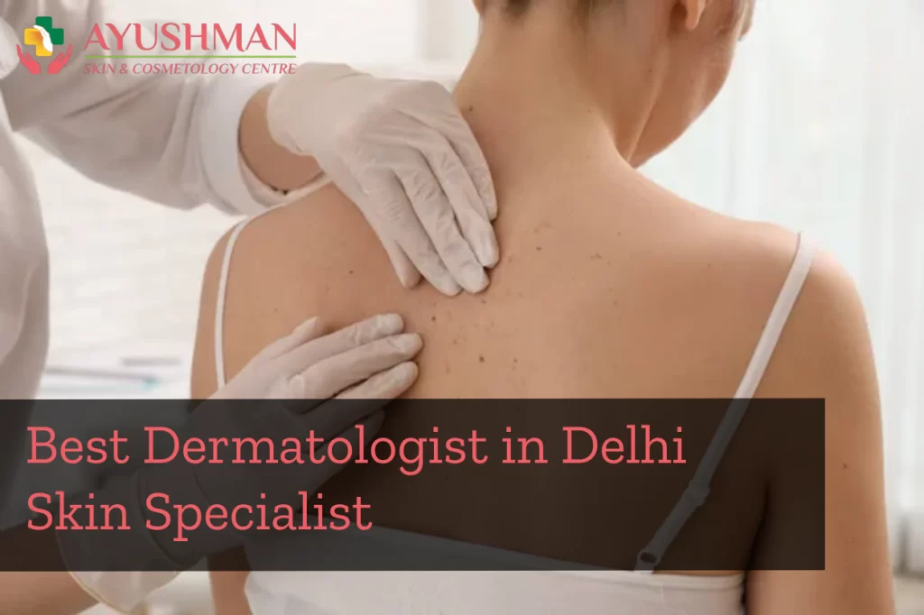 Dermatologist in Delhi