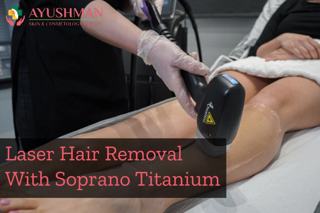 Laser Hair Removal With Soprano Titanium