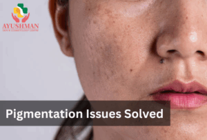 Pigmentation Issues Solved