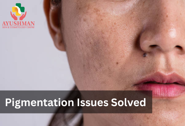 Pigmentation Issues Solved